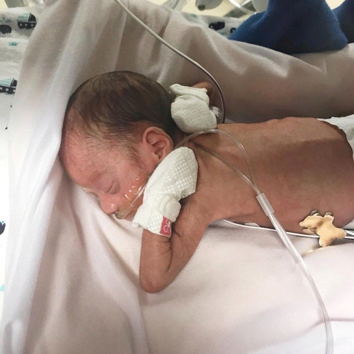 Goumikids Soft Organic No Scratch Baby Infant Hand Mittens, Preemie, Diamond Dot - VMInnovations