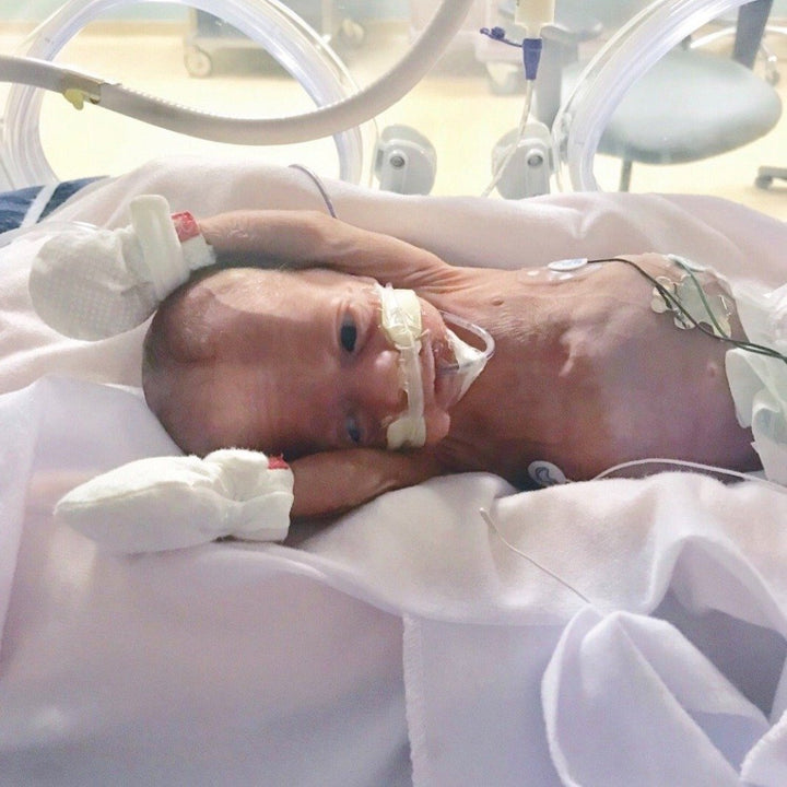 Goumikids Soft Organic No Scratch Baby Infant Hand Mittens, Preemie, Diamond Dot - VMInnovations