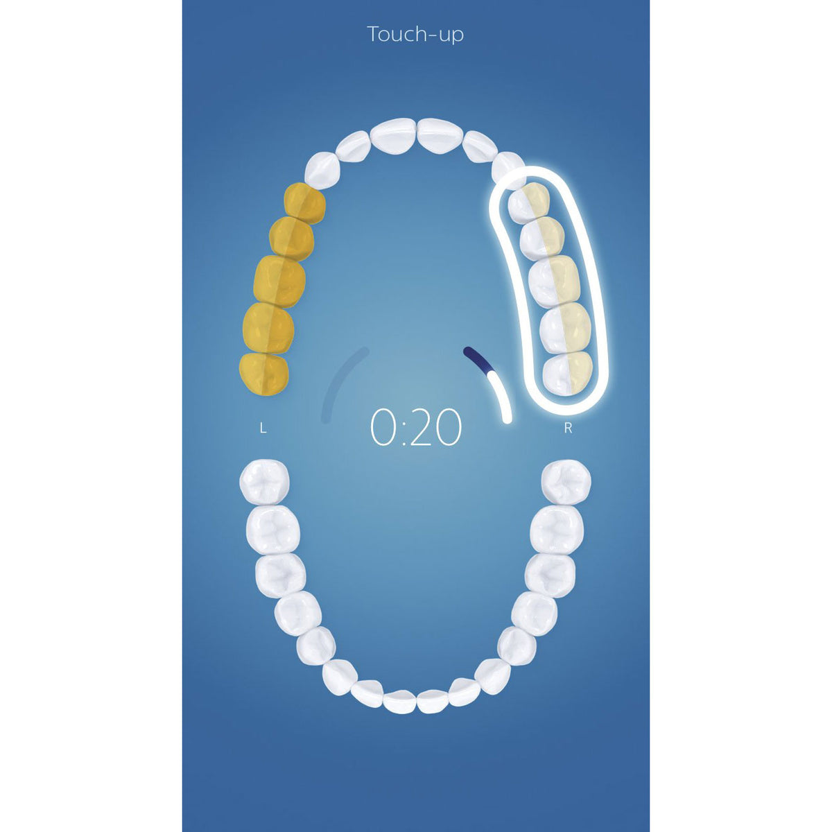 Philips Sonicare FlexCare Platinum Sonic Electric Rechargeable Toothbrush, White - VMInnovations