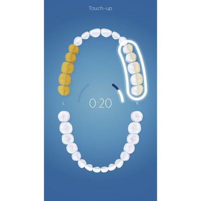 Philips Sonicare FlexCare Platinum Sonic Electric Rechargeable Toothbrush, White - VMInnovations